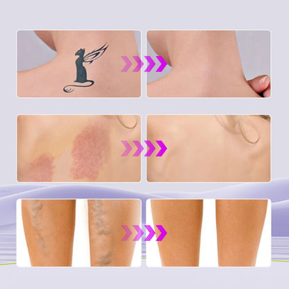 💜KAUFEN SIE 2 UND ERHALTEN SIE 1 GRATIS💜All-in-One-Feuchtigkeitscreme, Concealer und Deckkraft Perfector