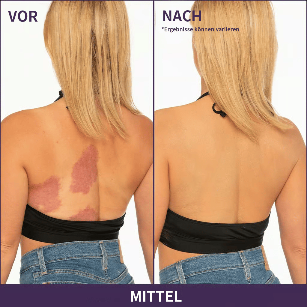 💜LETZTER TAG – KAUF 1, ERHALTE 1 GRATIS💜 Soft Matte Cream Concealer