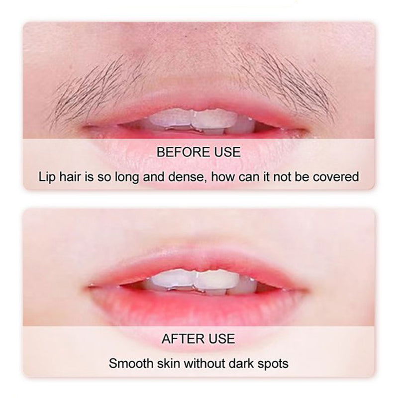 💜LETZTER TAG – KAUF 1, ERHALTE 1 GRATIS💜Sanfte & schmerzfreie Creme zur Haarentfernung im Gesicht