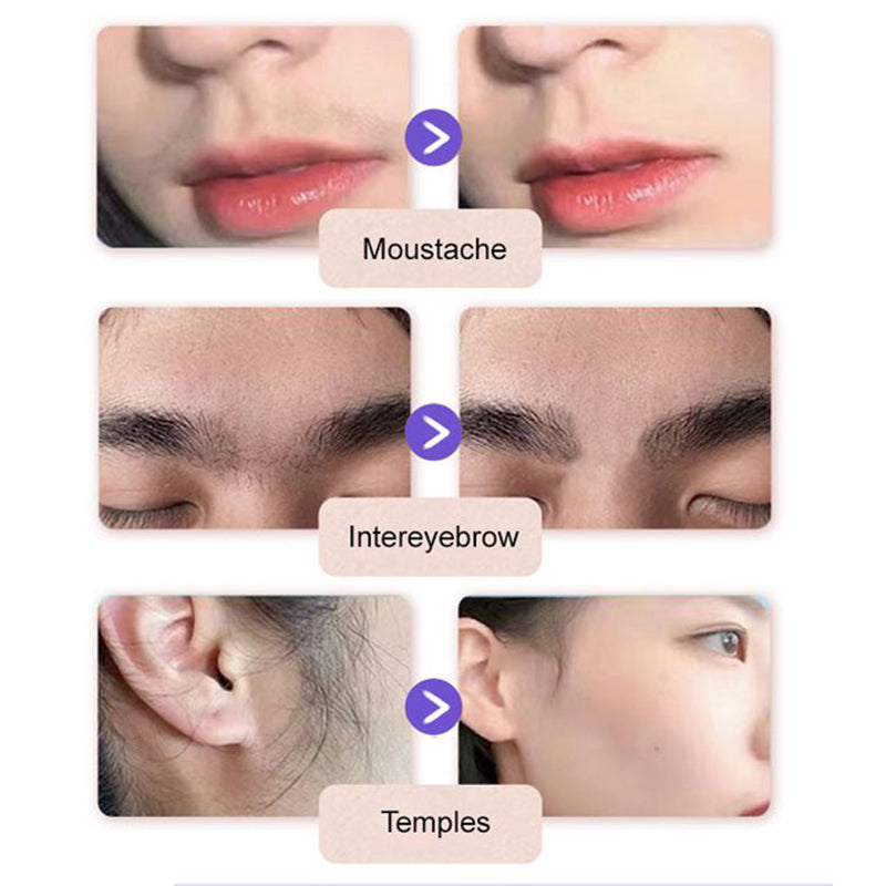 💜LETZTER TAG – KAUF 1, ERHALTE 1 GRATIS💜Sanfte & schmerzfreie Creme zur Haarentfernung im Gesicht